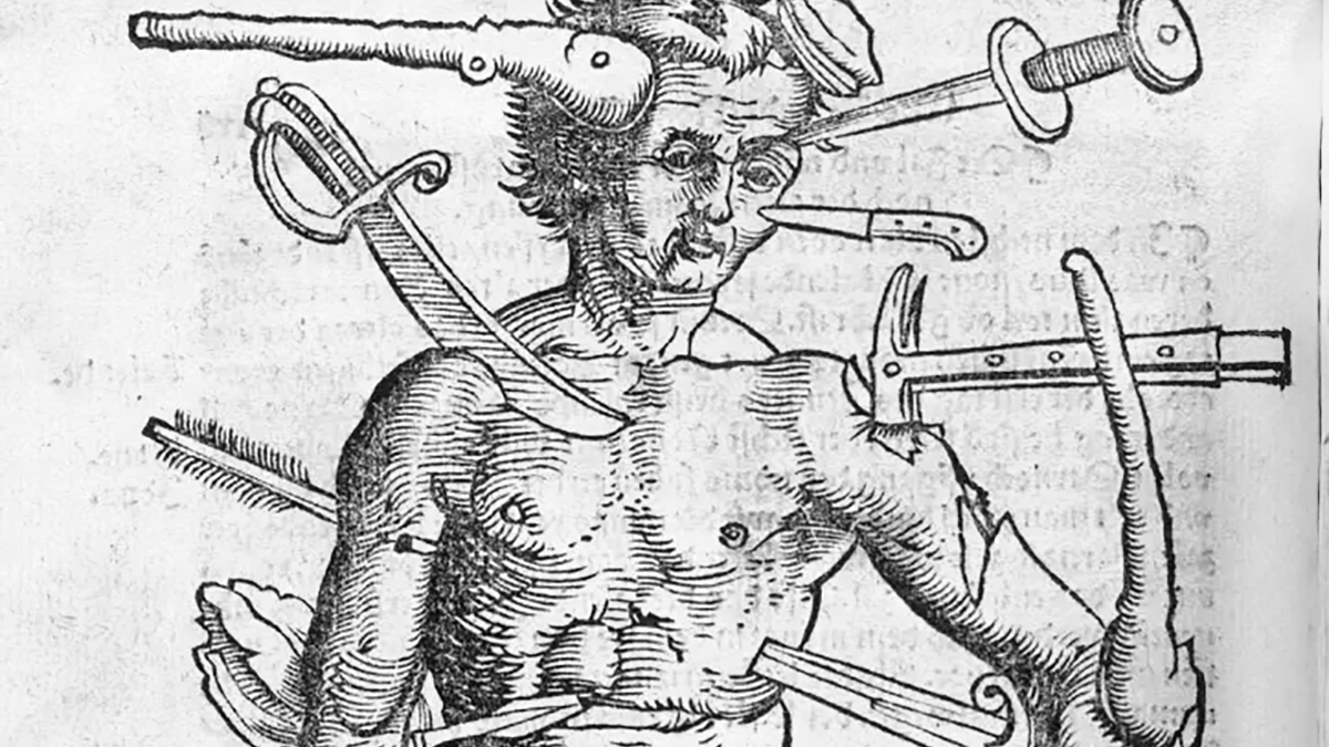 Medieval woodcut of a man with many wounds.
